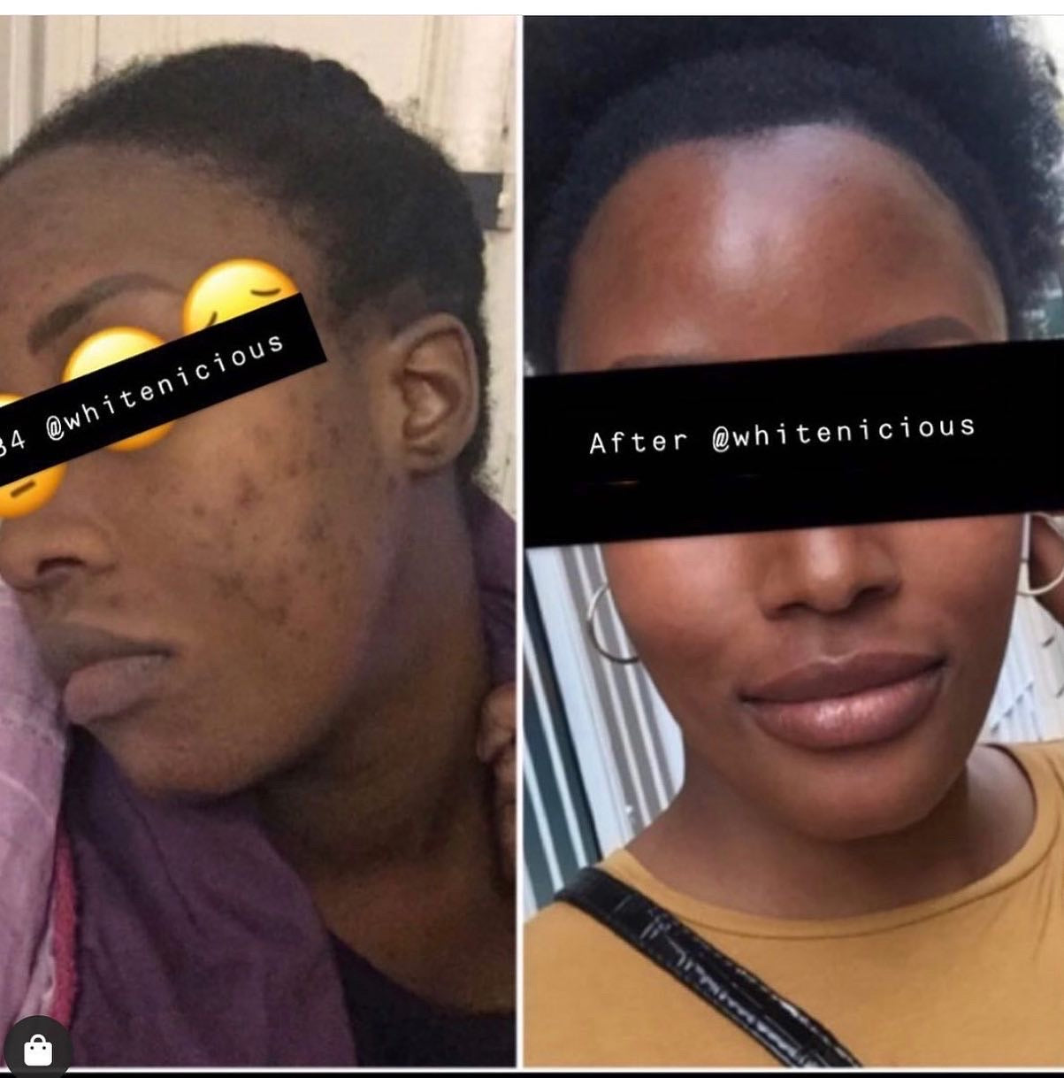 Full Face & Neck Bleaching Cream                                      Blac Chyna                                                       30G | 60G