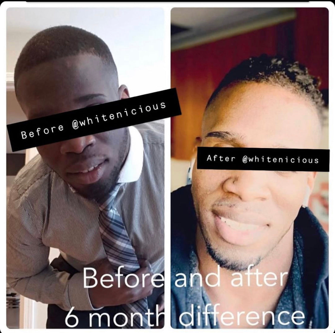 Full Face & Neck Bleaching Cream                                      Blac Chyna                                                       30G | 60G