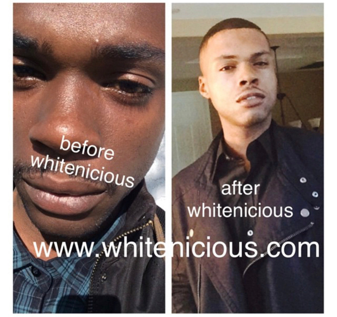 Full Face & Neck Bleaching Cream                                      Blac Chyna                                                       30G | 60G