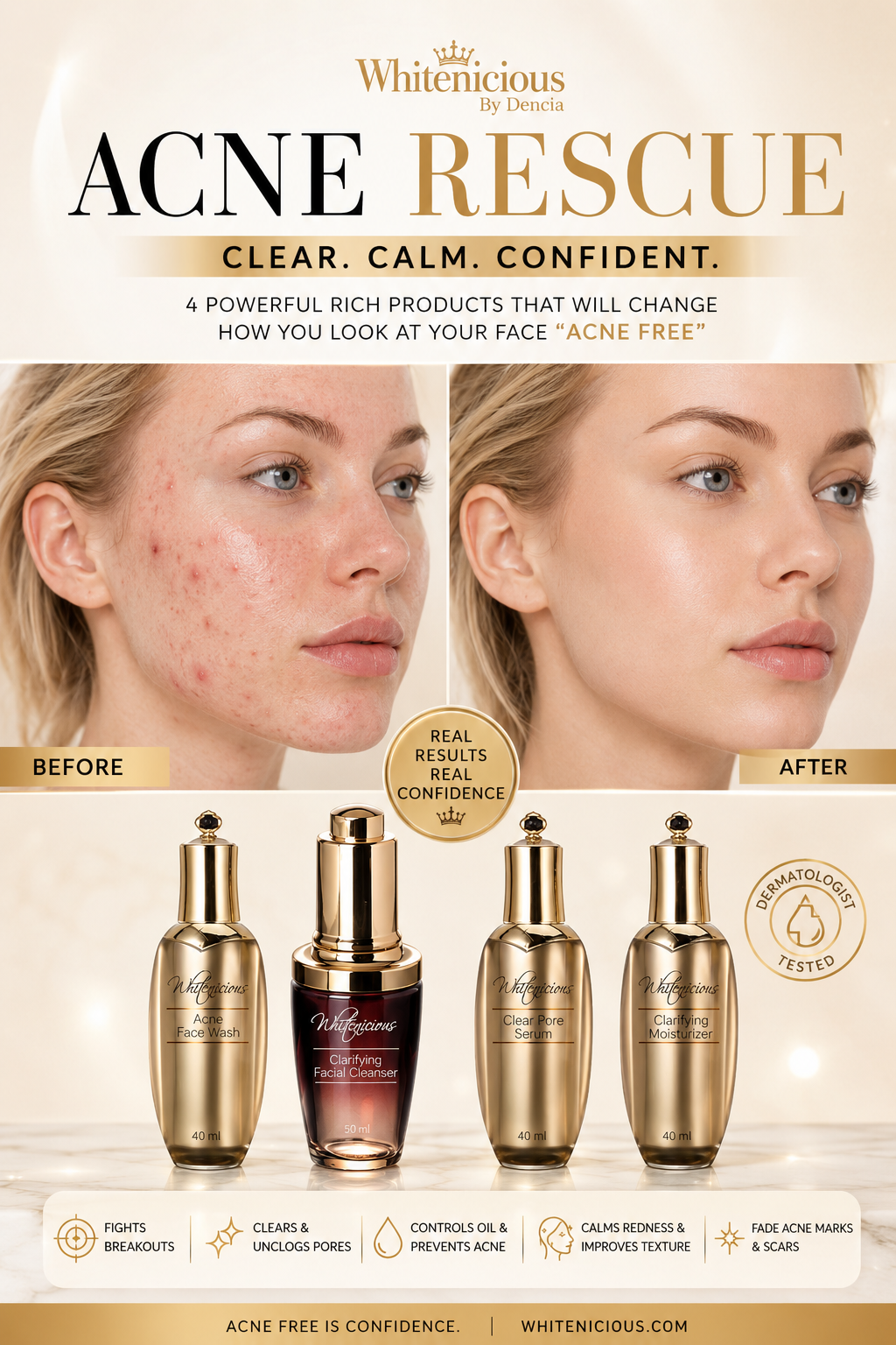 ACNE RESCUE