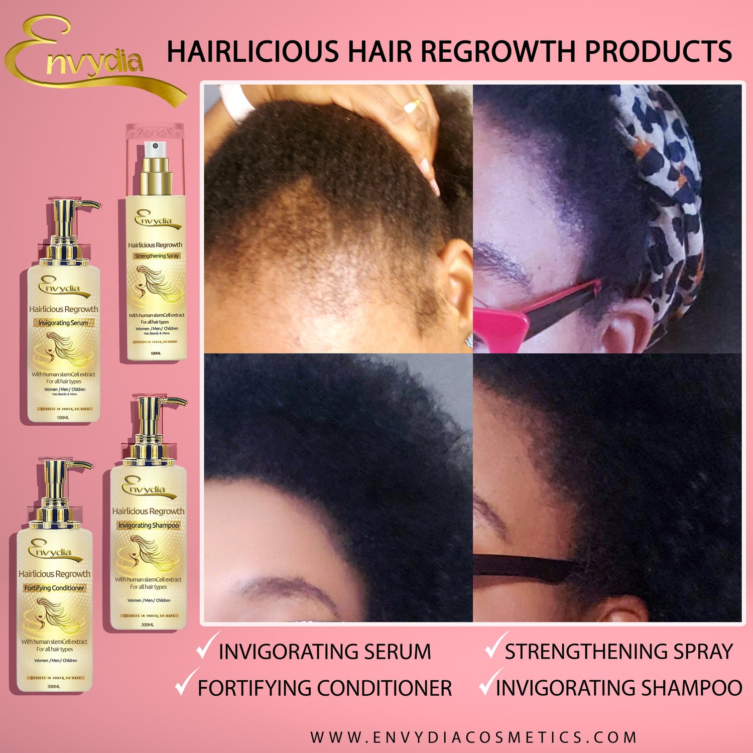 HAIR GROWTH & REGROWTH PRODUCTS