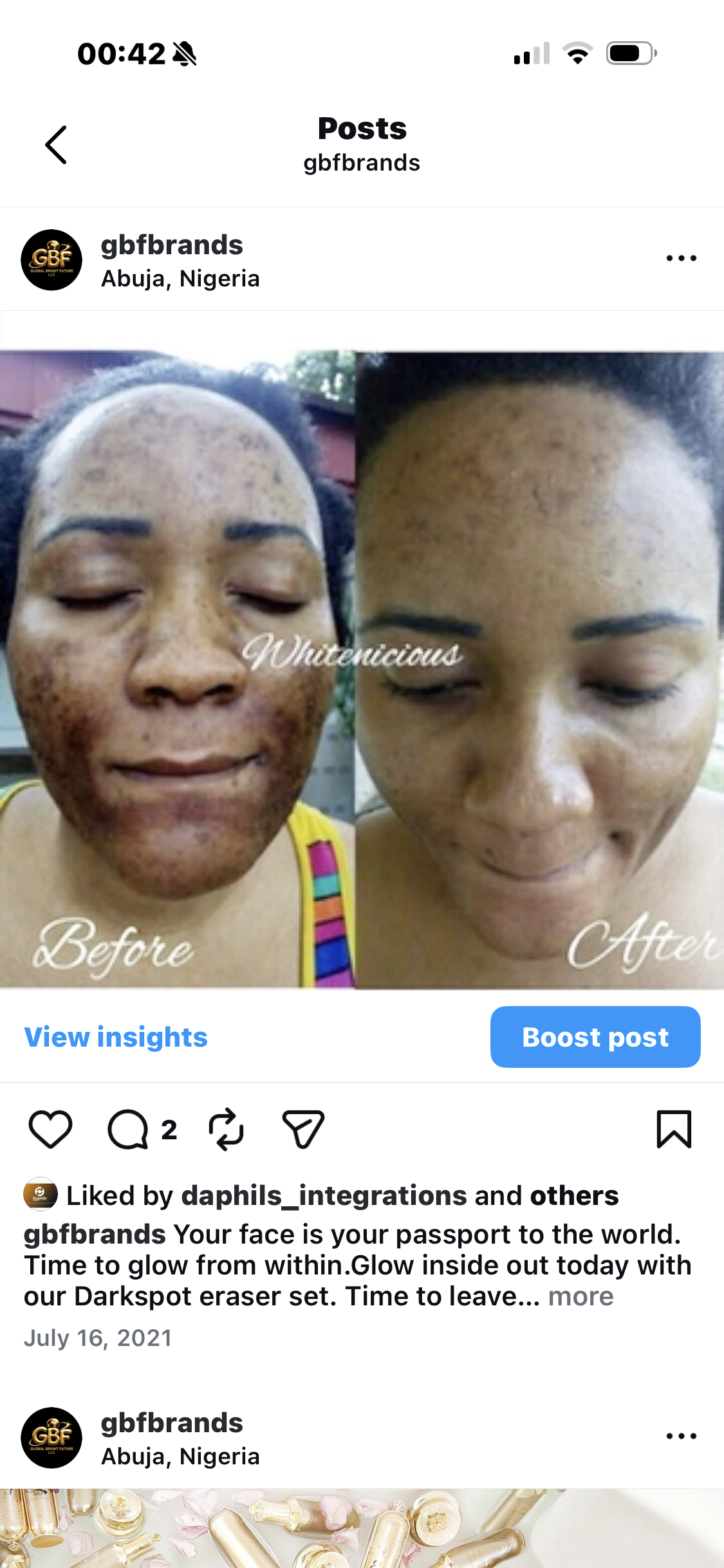 FULL FACE LIGHTENING SETS
