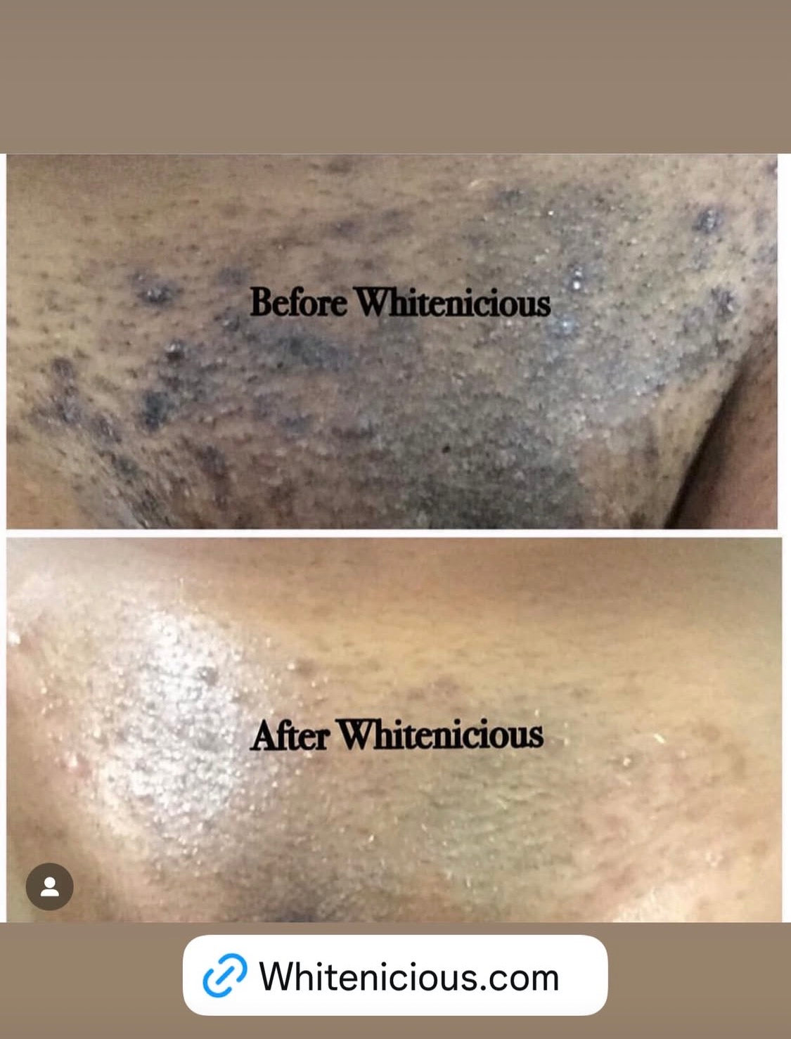 Intimate Areas Brightening Cream