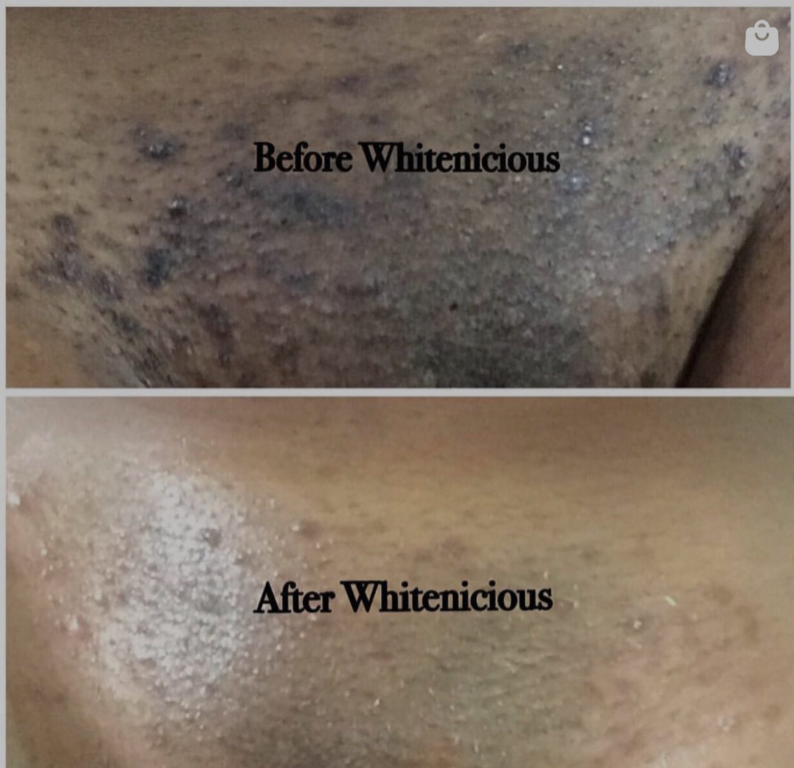 Intimate Area Cream 100Ml