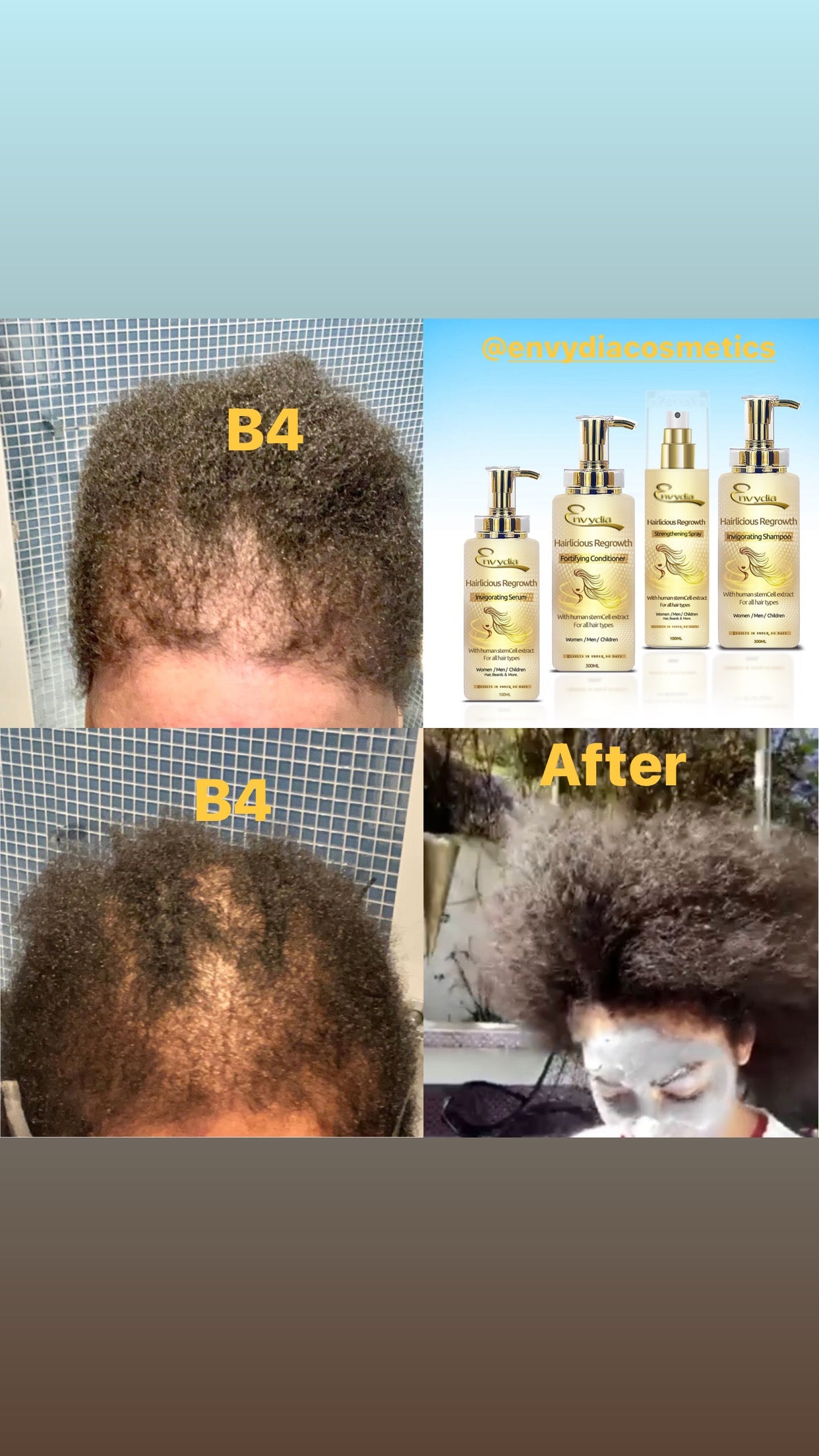 Hair Regrowth Full Set