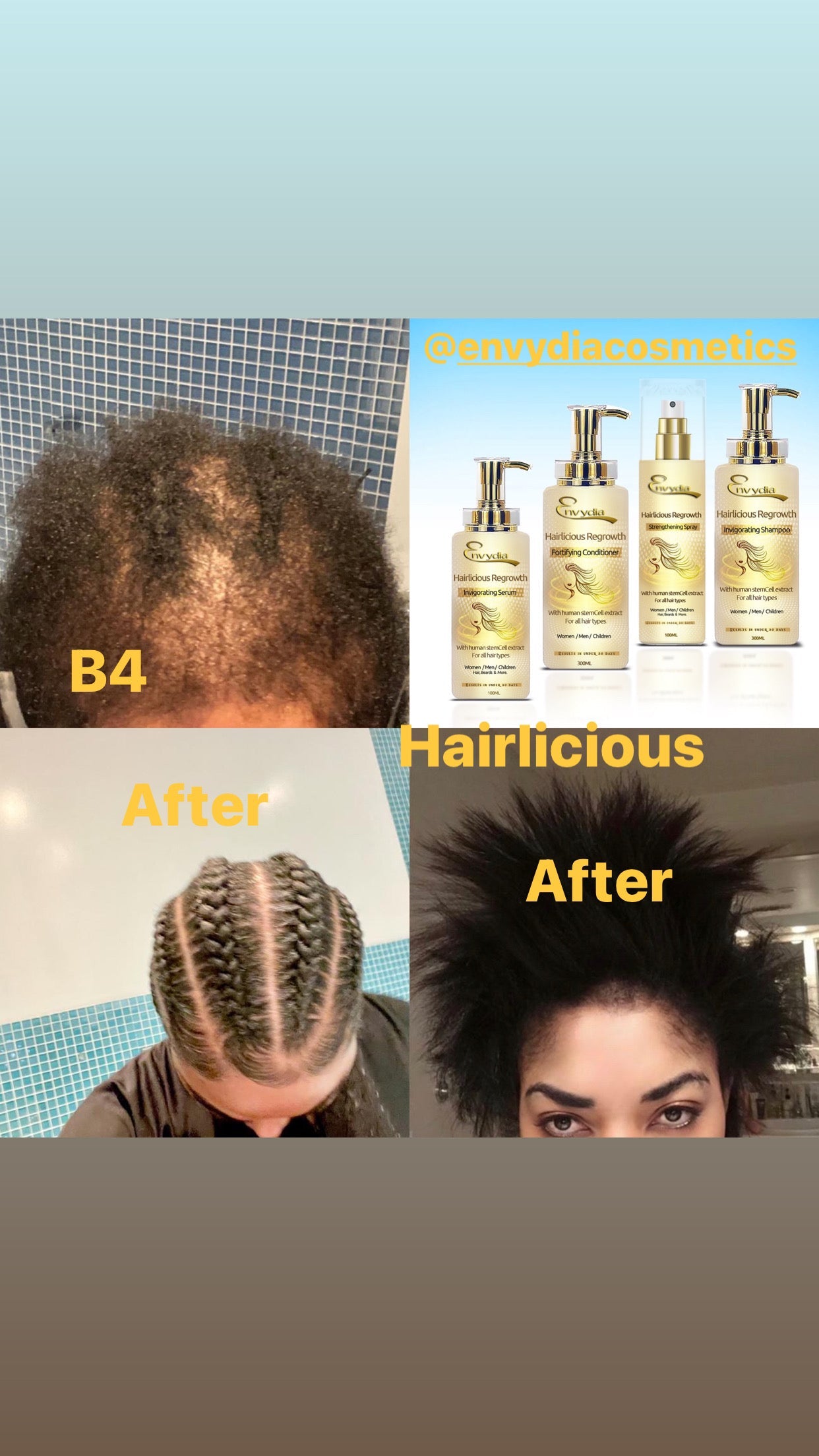 Hair Regrowth Full Set