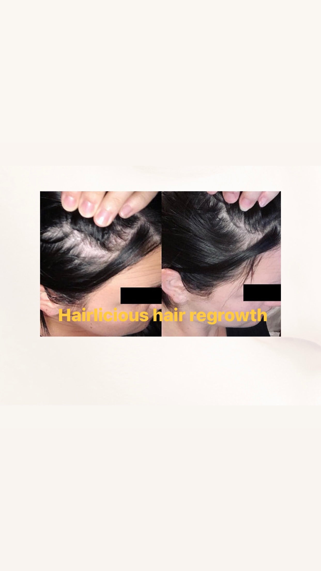 Hairlicious Regrowth  Invigorating Serum