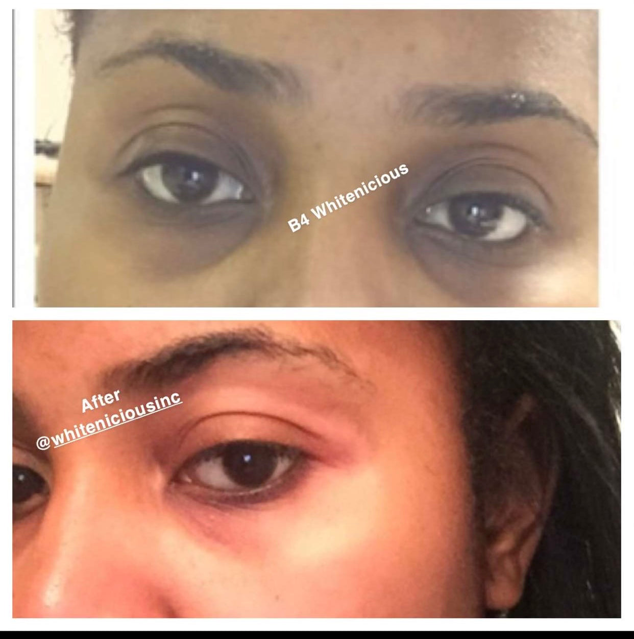 Sun Burn Face Fixer Cream